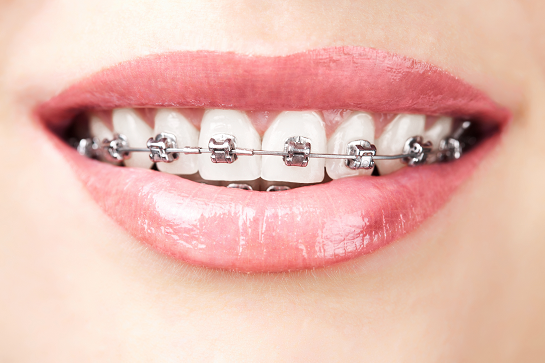 牙槽骨薄能做牙齿矫正吗