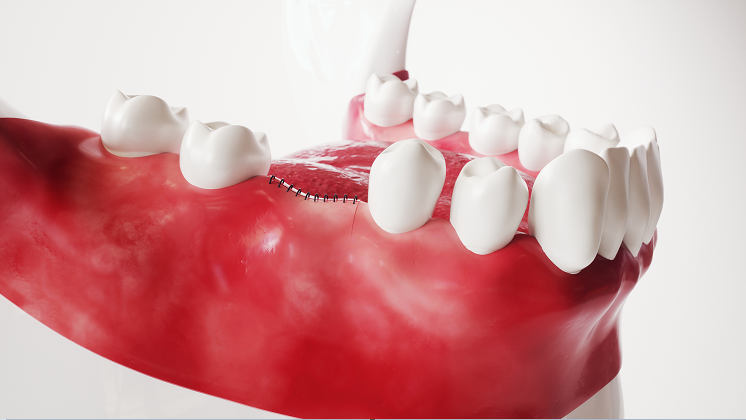再生牙齿技术最新消息