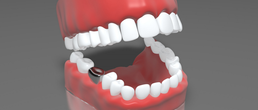 常用的假牙种类的介绍.jpg