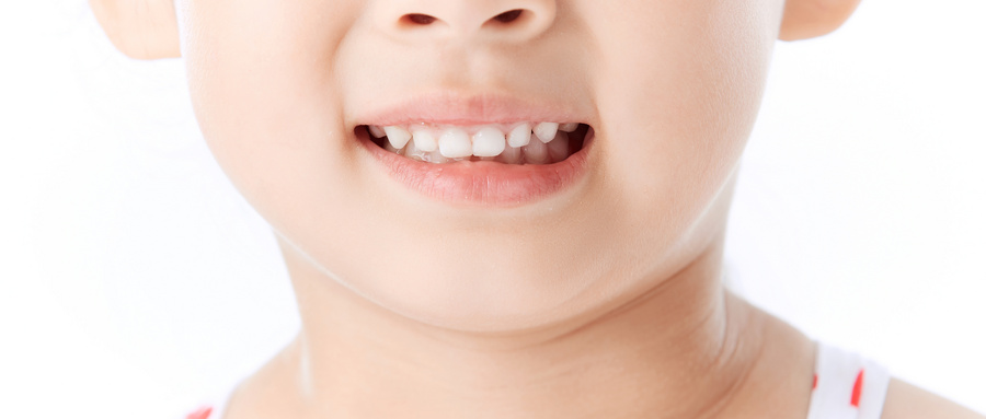 什么日常习惯会导致牙齿畸形？