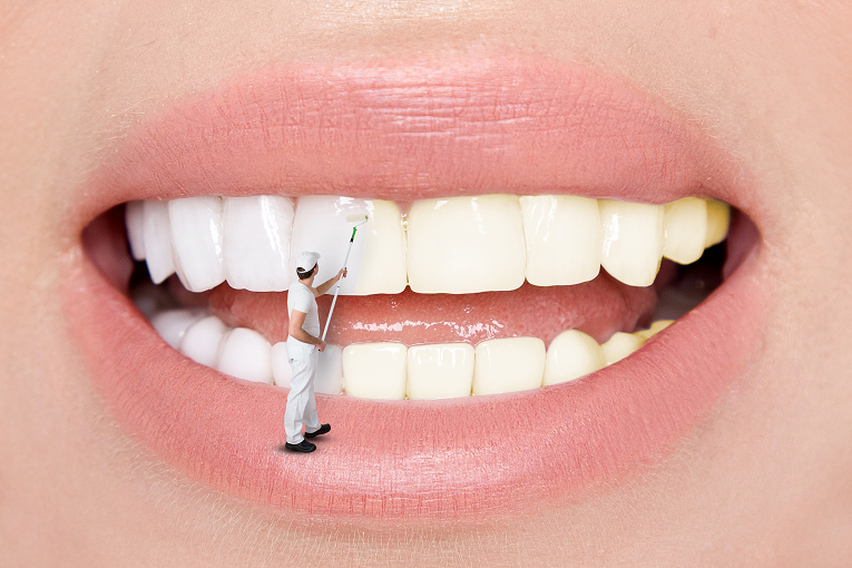 冷光美白对牙齿有伤害吗？