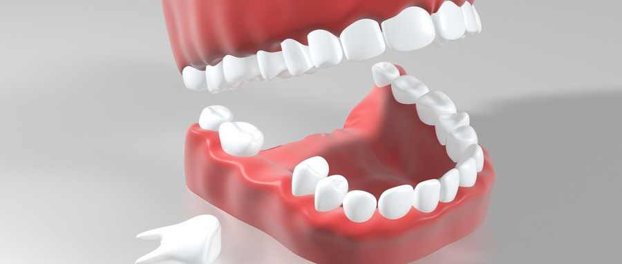什么是后天性牙齿缺失？杭州补牙哪个医院好？