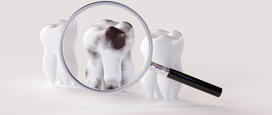 慢性牙髓炎怎么自查？