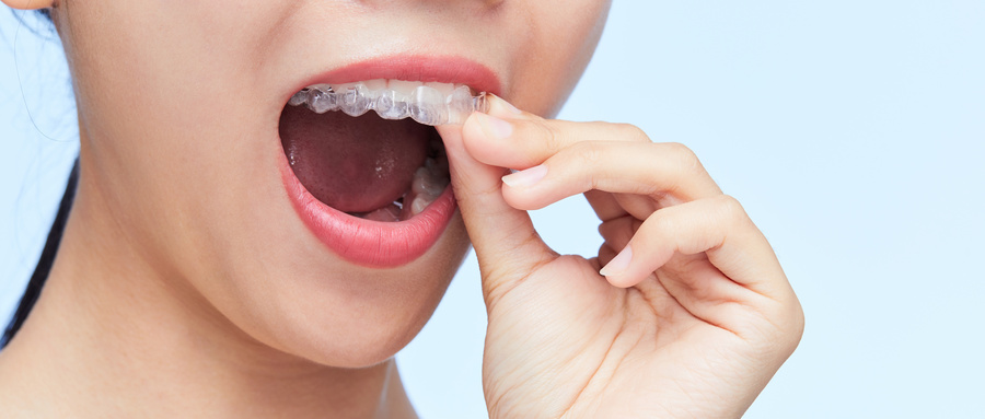 牙齿矫正会导致蛀牙越来越多吗？
